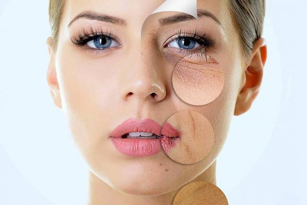 Rejuvenicimiento facial